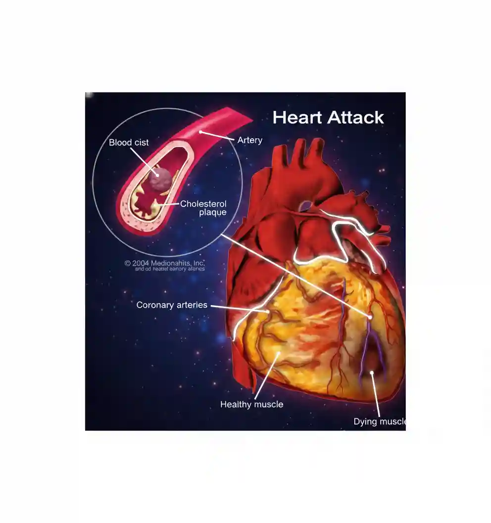 Healthy Heart, Healthy Life: Understanding and Managing High Blood Pressure